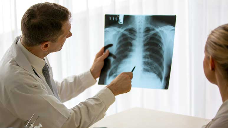Doctor holding x-ray of lungs and reading
