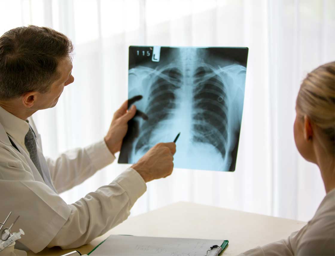 Doctor holding x-ray of lungs and reading