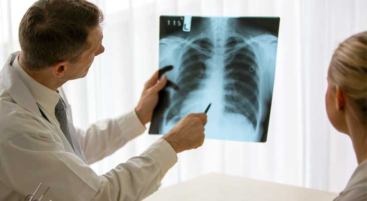 Doctor holding x-ray of lungs and reading