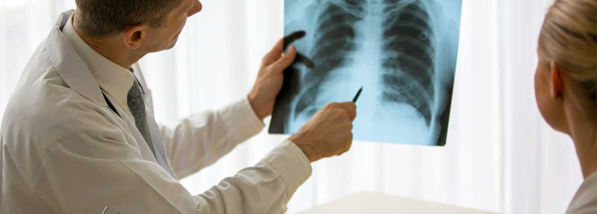 Doctor holding x-ray of lungs and reading