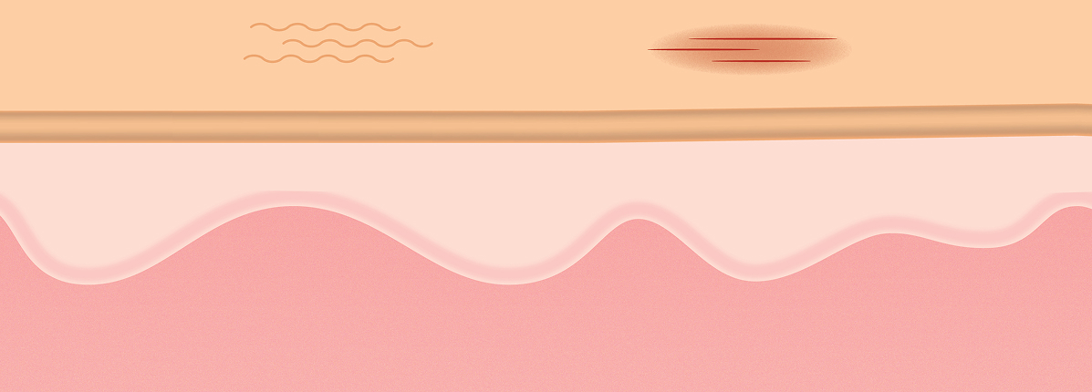 Animated skin layers